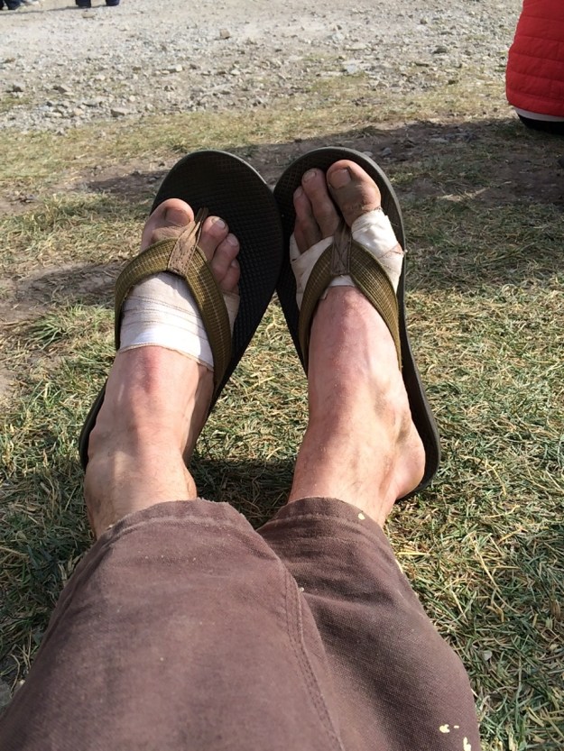 Tape is awesome. Flip flops are awesome.